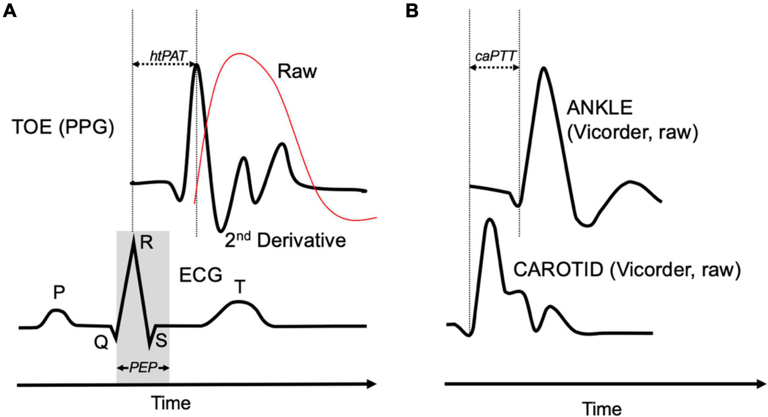 Pulse-wave velocity assessments derived from a simple photoplethysmography device: Agreement with a referent device